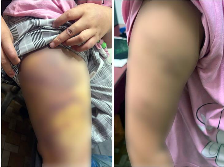Bố ruột bé gái 11 tuổi bị người tình của mẹ bạo hành xót xa: Bố ruột bé gái 11 tuổi bị người tình của mẹ bạo hành xót xa:
