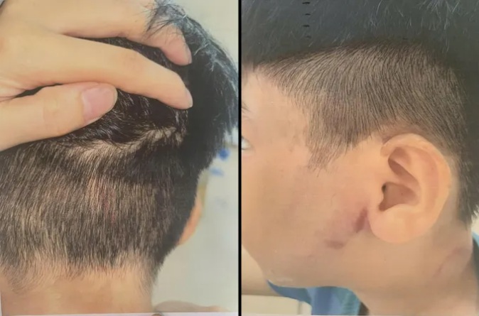 Ch&aacute;u trai gọi điện cầu cứu b&agrave; ngoại v&igrave; bị bố đẻ đ&aacute;nh đập: Đối tượng bỏ trốn sau khi xảy ra sự việc - Ảnh 1.