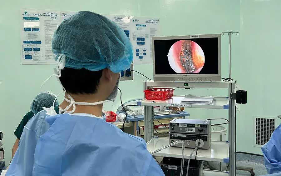 Trẻ bị họai tử ni&ecirc;m mạc mũi v&igrave; pin c&uacute;c &aacute;o cần được ph&aacute;t hiện sớm - Ảnh 1.