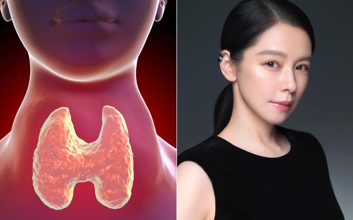 PGS TS Nguyễn Lân Hiếu chỉ đích danh 1 thói quen ăn uống hại tim mạch, rất nhiều người Việt mắc phải - Ảnh 1.
