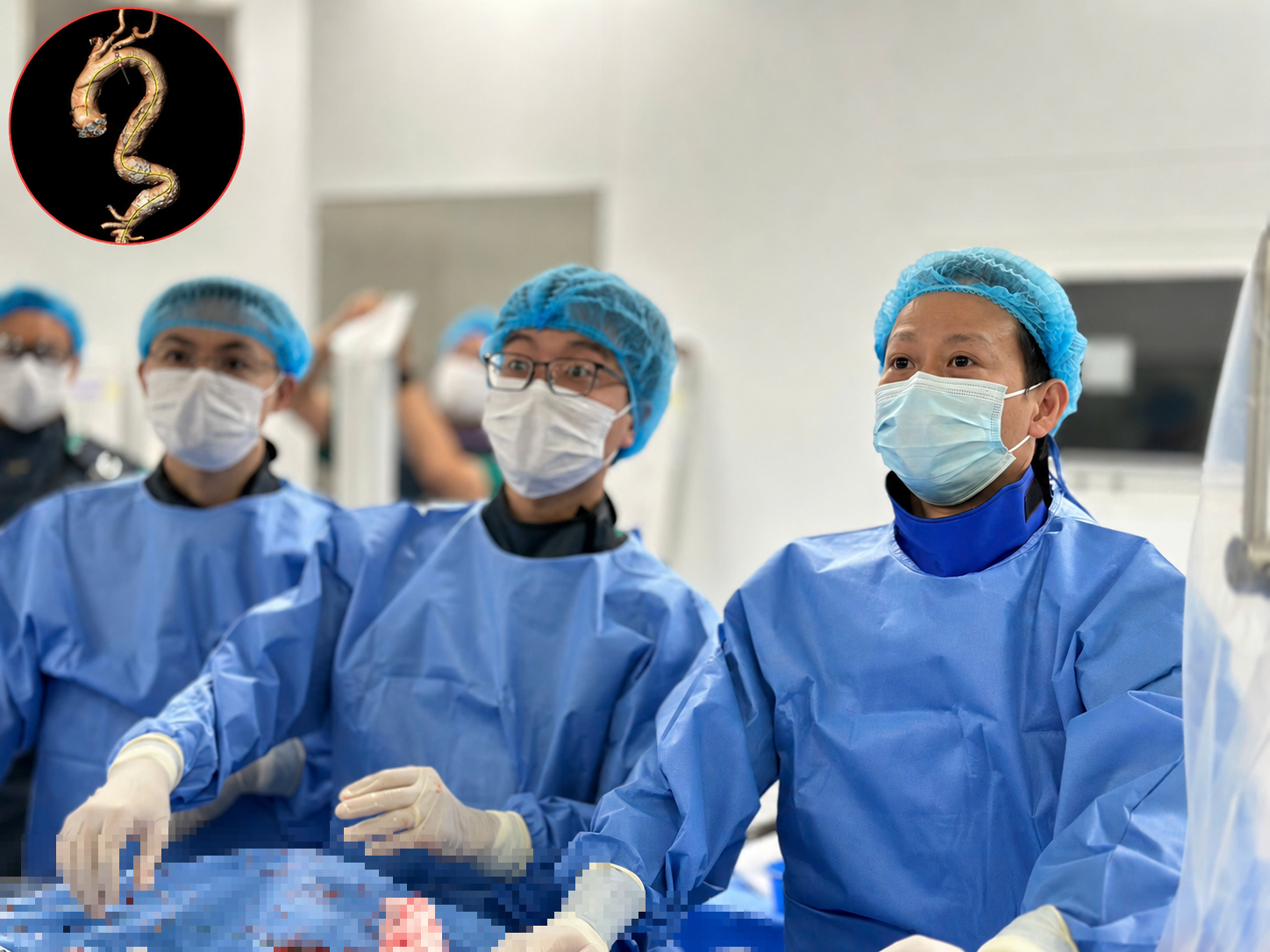 Một bệnh viện tuyến tỉnh đạt chứng nhận quốc tế về chăm s&oacute;c suy tim: Ti&ecirc;u chuẩn ch&acirc;u &Acirc;u được &aacute;p dụng ra sao? - Ảnh 2.