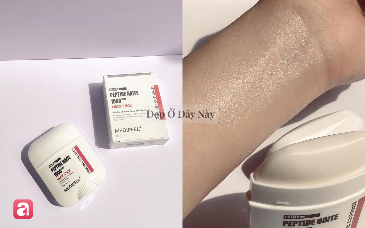 V&ugrave;ng da dễ lộ dấu hiệu l&atilde;o h&oacute;a m&agrave; c&aacute;c chị em thường dễ bỏ qua nhất - Ảnh 2.