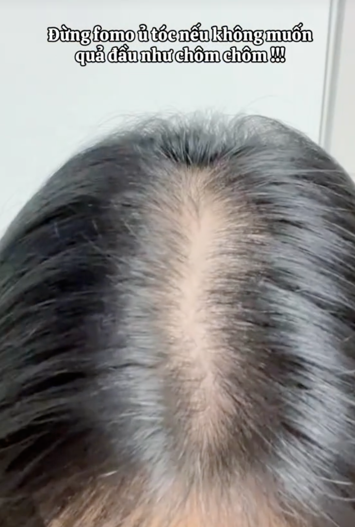 - Ảnh 1. - Ảnh 1.