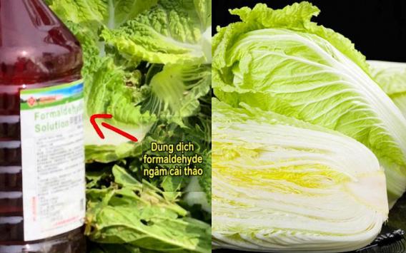 Nam t&agrave;i xế nguy kịch v&igrave; bệnh Whitmore - Ảnh 2.