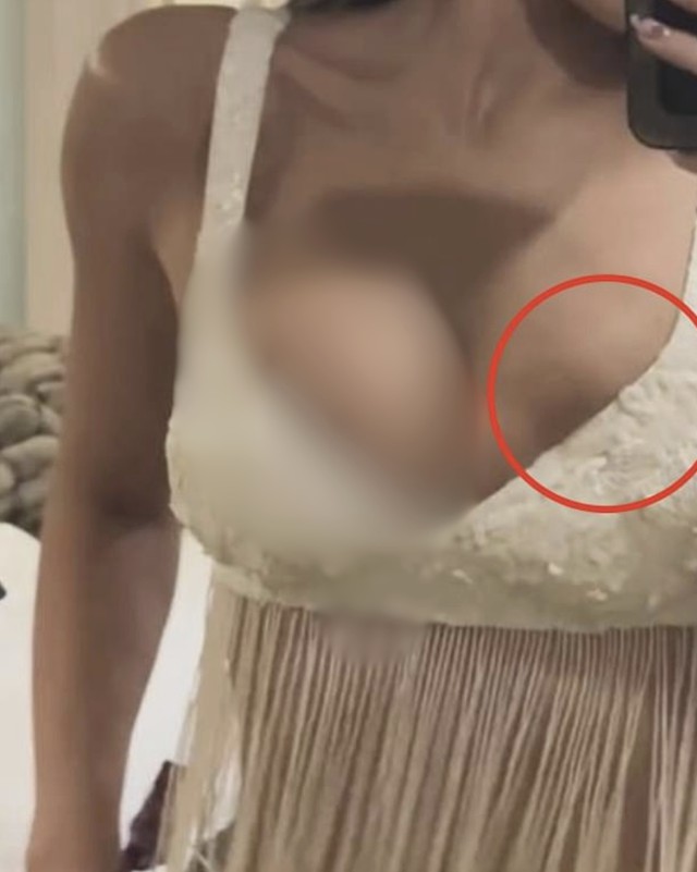 Kylie Jenner đòi bộ ngực khác sau tin đồn vỡ túi ngực vì bung xoã quá hăng- Ảnh 4.