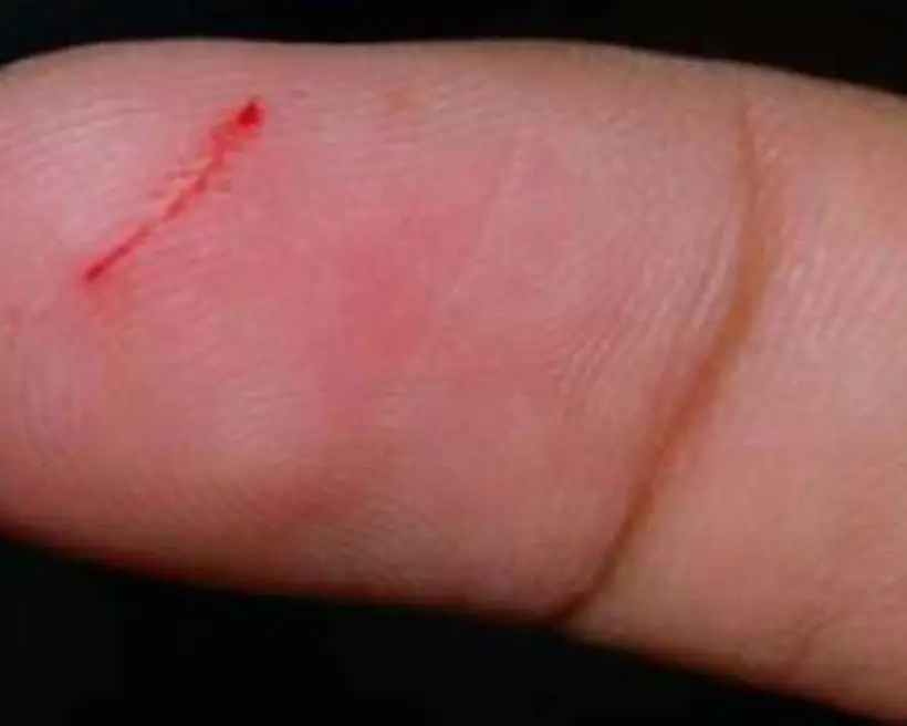 Người đ&agrave;n &ocirc;ng bất ngờ nhiễm HIV, nguy&ecirc;n nh&acirc;n được cho l&agrave; từ một th&oacute;i quen rất nhiều người c&oacute; - Ảnh 3.