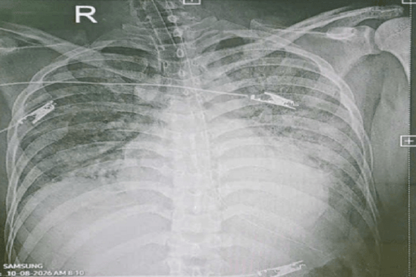  - Ảnh 2.