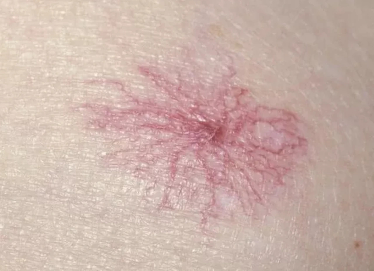  - Ảnh 4.