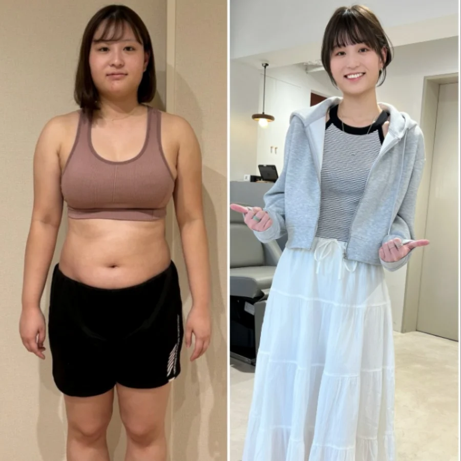 Từng tăng gần 20kg v&igrave; &aacute;p lực c&ocirc;ng việc, c&ocirc; g&aacute;i 26 tuổi 