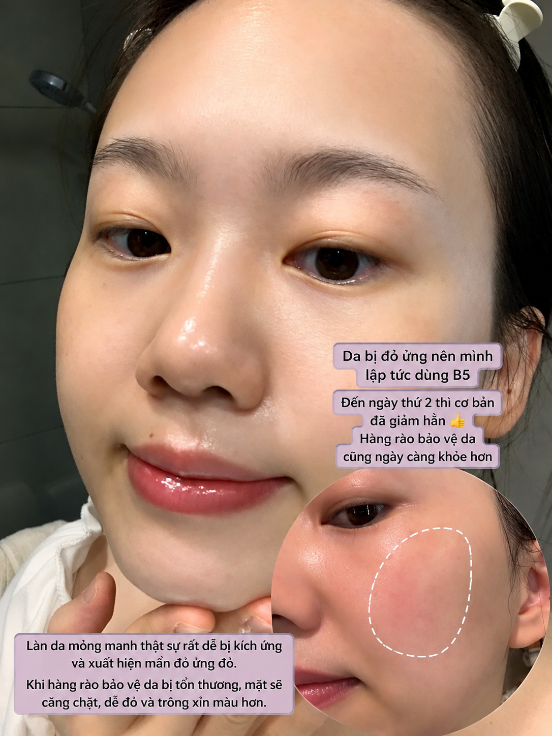 Mặt mộc đẹp kh&ocirc;ng chỉ nhờ nền da sẵn c&oacute;: C&ocirc; g&aacute;i chia sẻ b&iacute; quyết phục hồi da nhạy cảm, dễ ửng đỏ chỉ với một thay đổi trong chu tr&igrave;nh skincare - Ảnh 1.