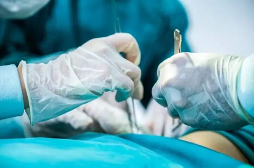 Cô gái 29 tuổi vùng kín “bị ăn mòn”, bác sĩ cảnh báo: Chỉ vài giờ thôi cũng có thể dẫn đến tử vong! - Ảnh 2.