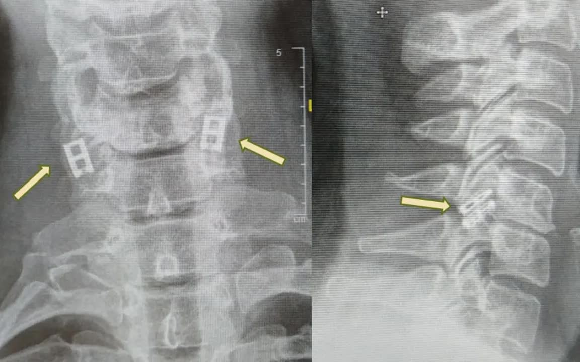  - Ảnh 1.