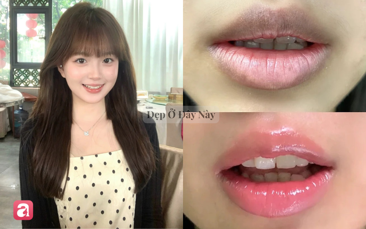 5 lọ dầu dưỡng m&ocirc;i l&ecirc;n m&agrave;u đẹp tự nhi&ecirc;n, cho m&ocirc;i căng mọng như được 