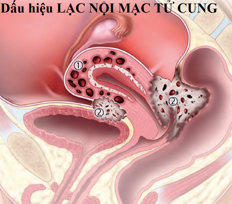 Gi&agrave;nh được giải điện ảnh cho bộ phim về ch&iacute;nh căn bệnh m&igrave;nh mắc phải nhưng 24 giờ sau, nữ đạo diễn phải nằm liệt giường - Ảnh 3.