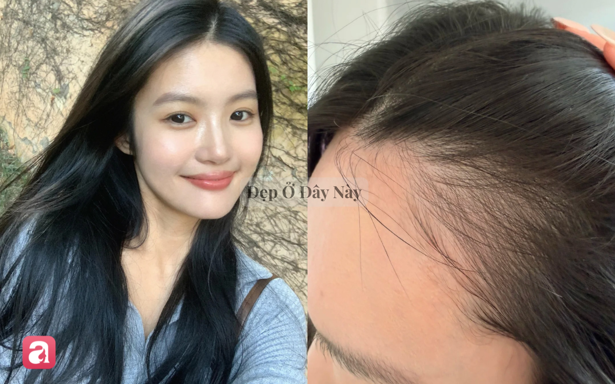 5 lọ dưỡng t&oacute;c bưởi 