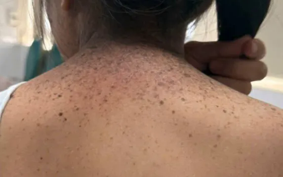 Ảnh: Bệnh viện Da liễu Trung ương