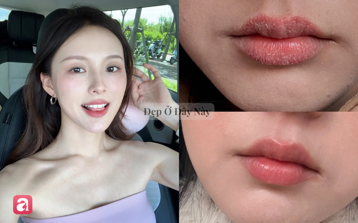 5 tẩy da chết m&ocirc;i 