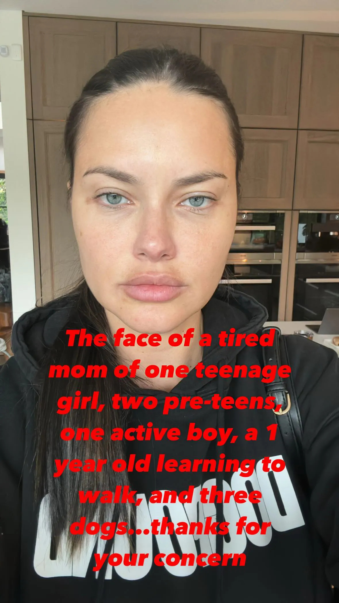 Adriana Lima lột x&aacute;c ngoạn mục ở tuổi 45: Từ biến dạng gương mặt th&agrave;nh biểu tượng sắc đẹp - Ảnh 5.