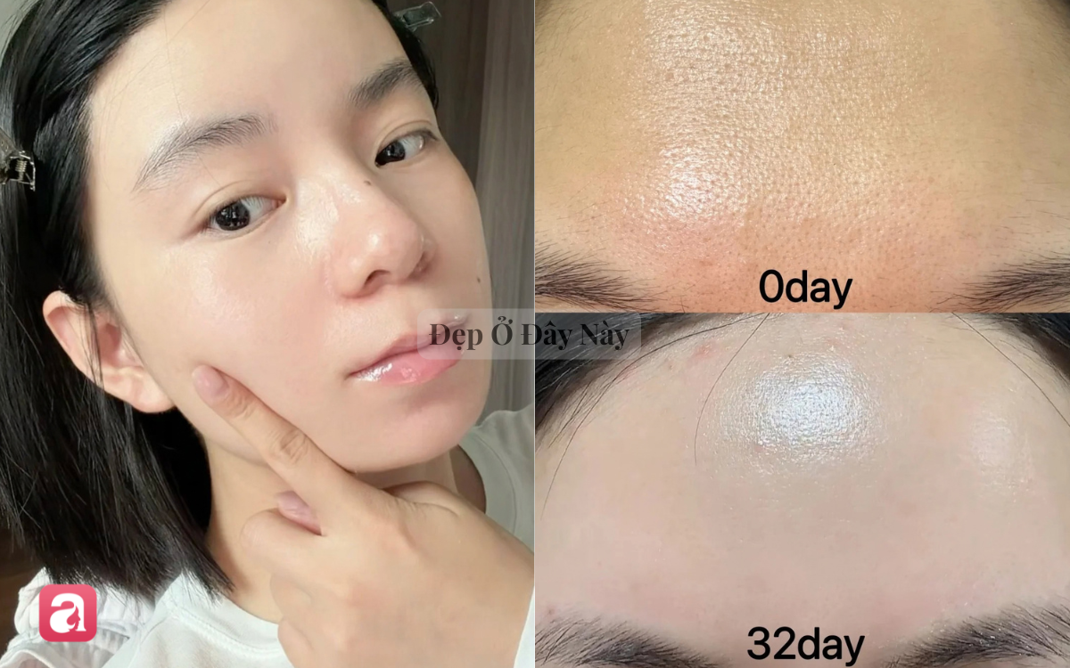 V&igrave; sao nhiều người chuyển từ tẩy da chết dạng hạt sang loại 