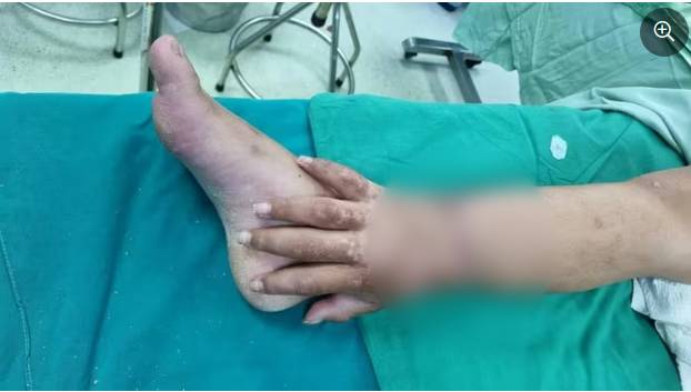 Người Việt SN 1982 v&agrave; những ca phẫu thuật 