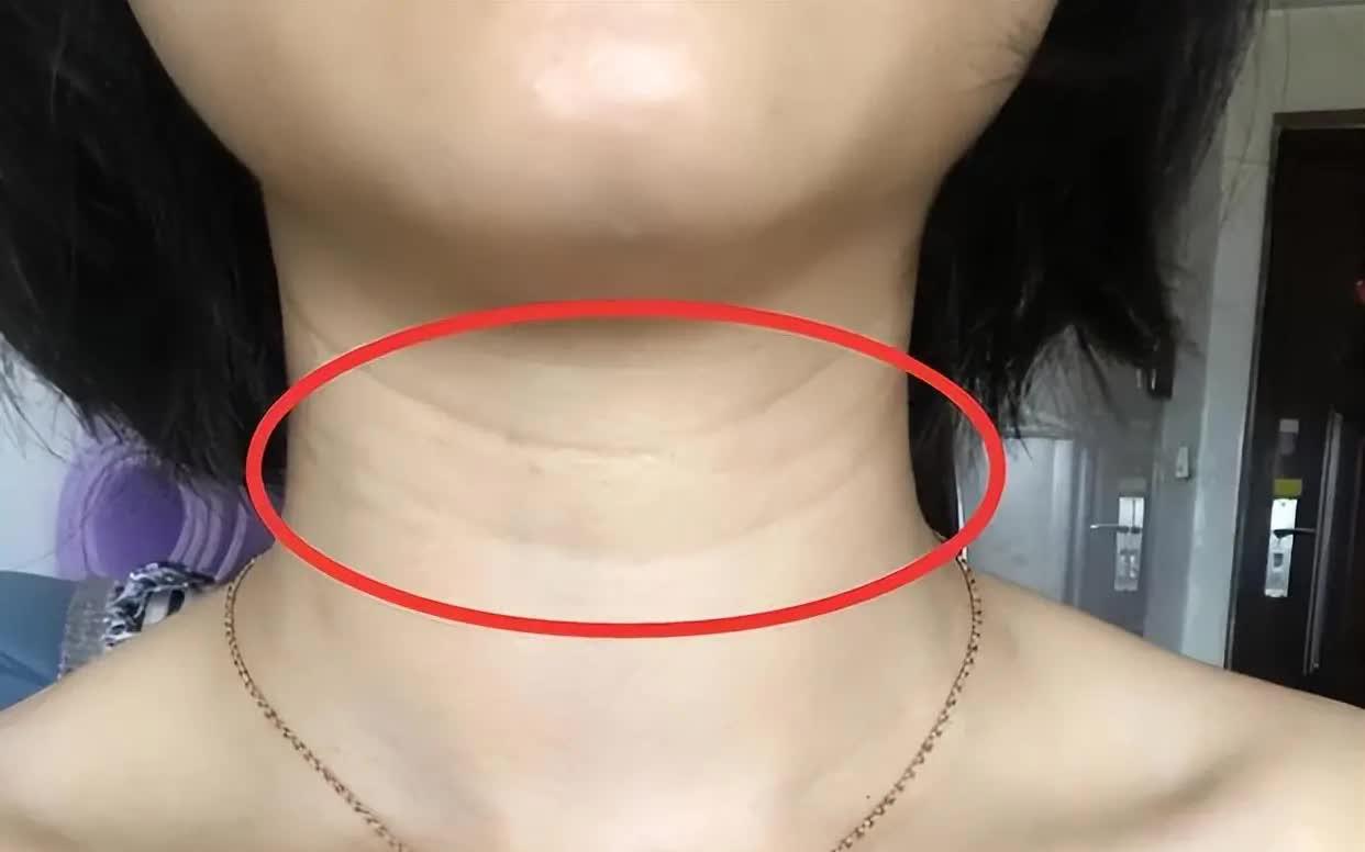V&igrave; sao ng&agrave;y c&agrave;ng nhiều người th&iacute;ch đặt một củ gừng dưới gối khi ngủ? - Ảnh 3.