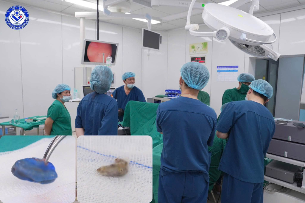 B&eacute; g&aacute;i 4 tuổi tiết dịch h&ocirc;i v&ugrave;ng k&iacute;n: Cảnh b&aacute;o dị vật &acirc;m đạo Nguy hiểm - Ảnh 2.
