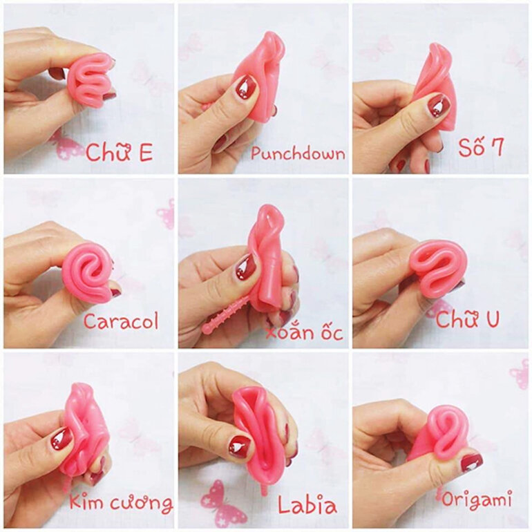 Nỗi lo nhiễm tr&ugrave;ng thận từ cốc nguyệt san: Cảnh b&aacute;o cho phụ nữ 30 tuổi - Ảnh 3.