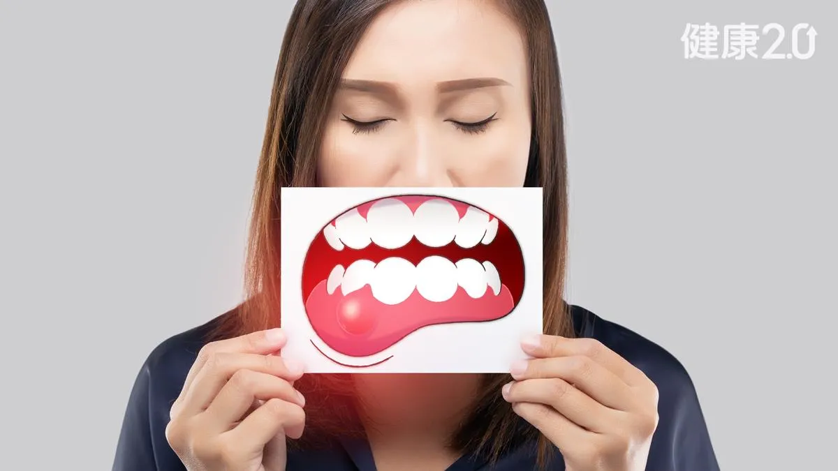 Uống cola khi đeo niềng răng trong suốt c&oacute; được kh&ocirc;ng? 3 lời khuy&ecirc;n an to&agrave;n cho răng - Ảnh 1.