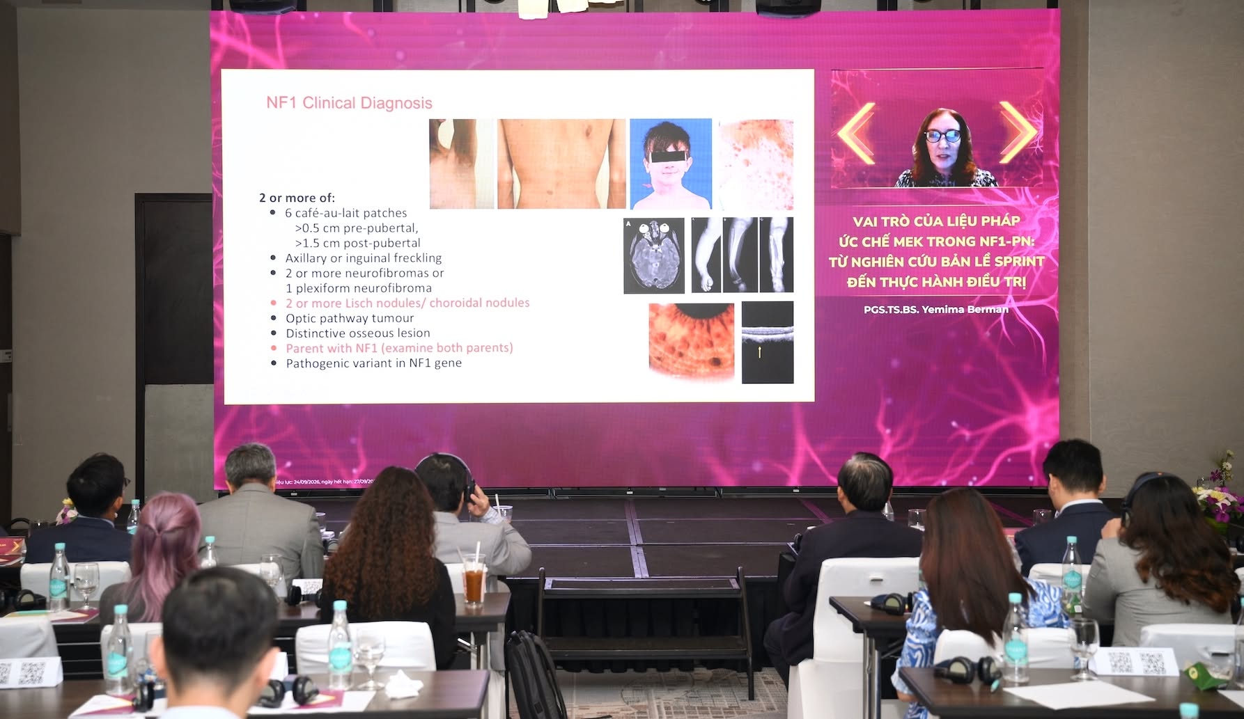 Bước tiến mới trong điều trị u xơ thần kinh tu&yacute;p 1 năm 2026 - Ảnh 3.