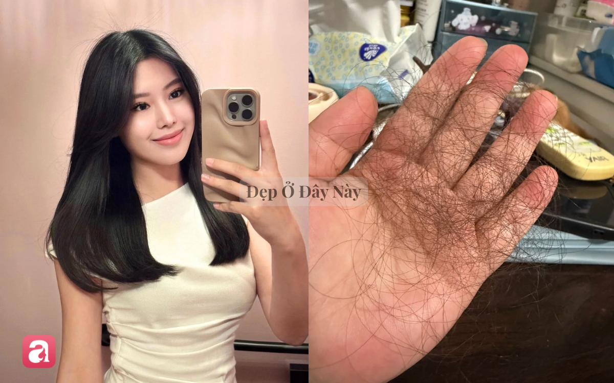 Vì sao nhiều người chăm tóc càng kỹ, tóc càng gãy rụng nhiều? - Ảnh 2.
