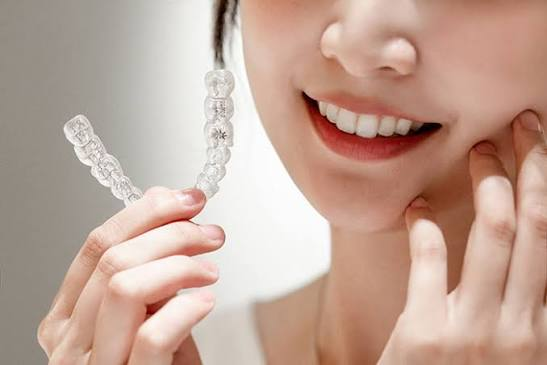 Uống cola khi đeo niềng răng trong suốt c&oacute; được kh&ocirc;ng? 3 lời khuy&ecirc;n an to&agrave;n cho răng - Ảnh 2.