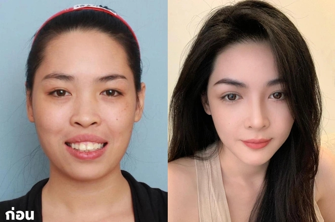 Vũ Thanh Quỳnh v&agrave; h&agrave;nh tr&igrave;nh lột x&aacute;c nhan sắc ấn tượng c&ugrave;ng drama miệt thị ngọai h&igrave;nh - Ảnh 5.