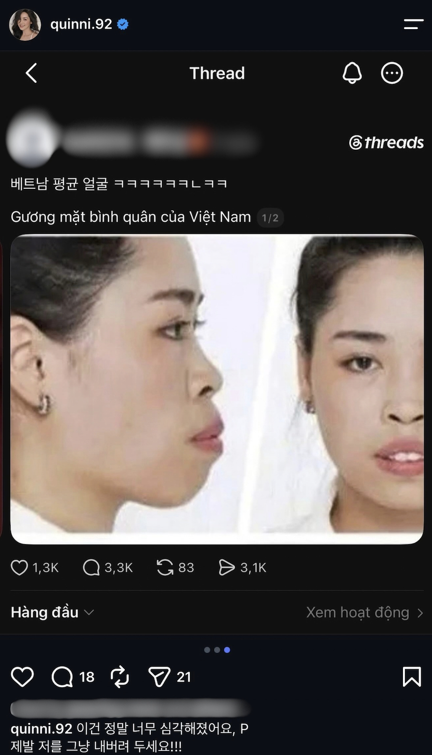 Vũ Thanh Quỳnh v&agrave; h&agrave;nh tr&igrave;nh lột x&aacute;c nhan sắc ấn tượng c&ugrave;ng drama miệt thị ngọai h&igrave;nh - Ảnh 1.