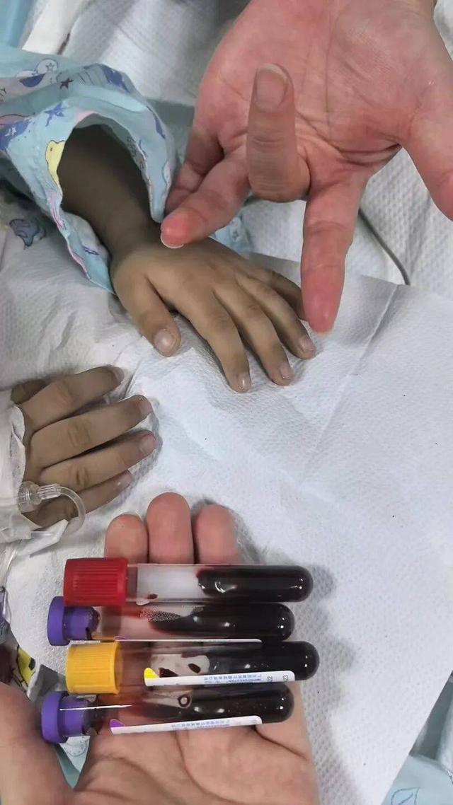 B&eacute; trai 3 tuổi nhập viện v&igrave; ngộ độc sau thời gian d&agrave;i ăn cơm, thức ăn để qua đ&ecirc;m - Ảnh 1.