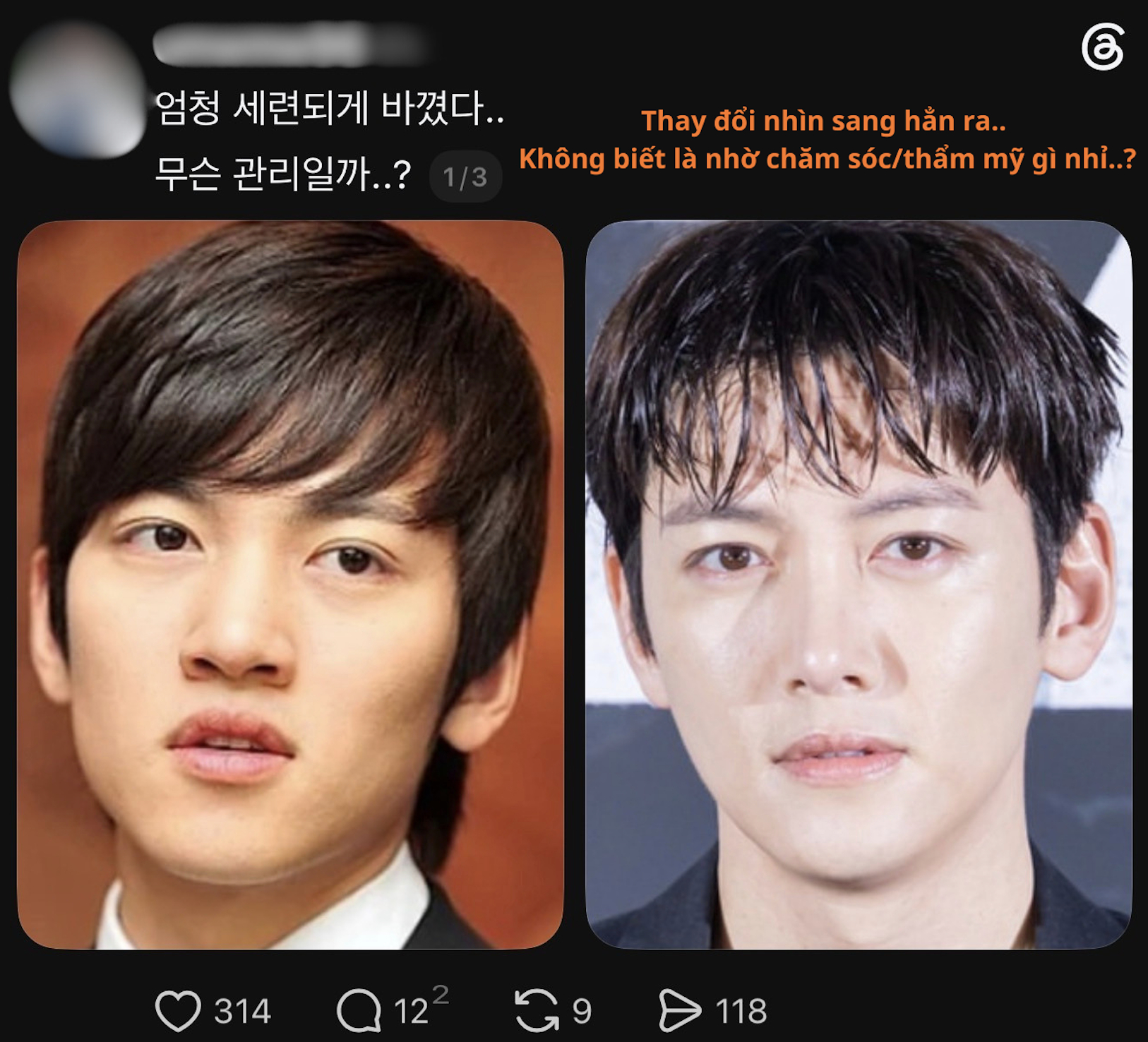 Ji Chang Wook v&agrave; h&agrave;nh tr&igrave;nh nhan sắc lột x&aacute;c đ&aacute;ng ch&uacute; &yacute; trước tuổi 40 - Ảnh 1.
