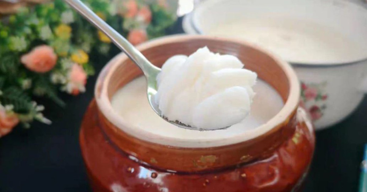 Ăn mỡ lợn mỗi ng&agrave;y suốt 3 năm, người phụ nữ 60 tuổi bất ngờ khi đi kh&aacute;m - Ảnh 2.