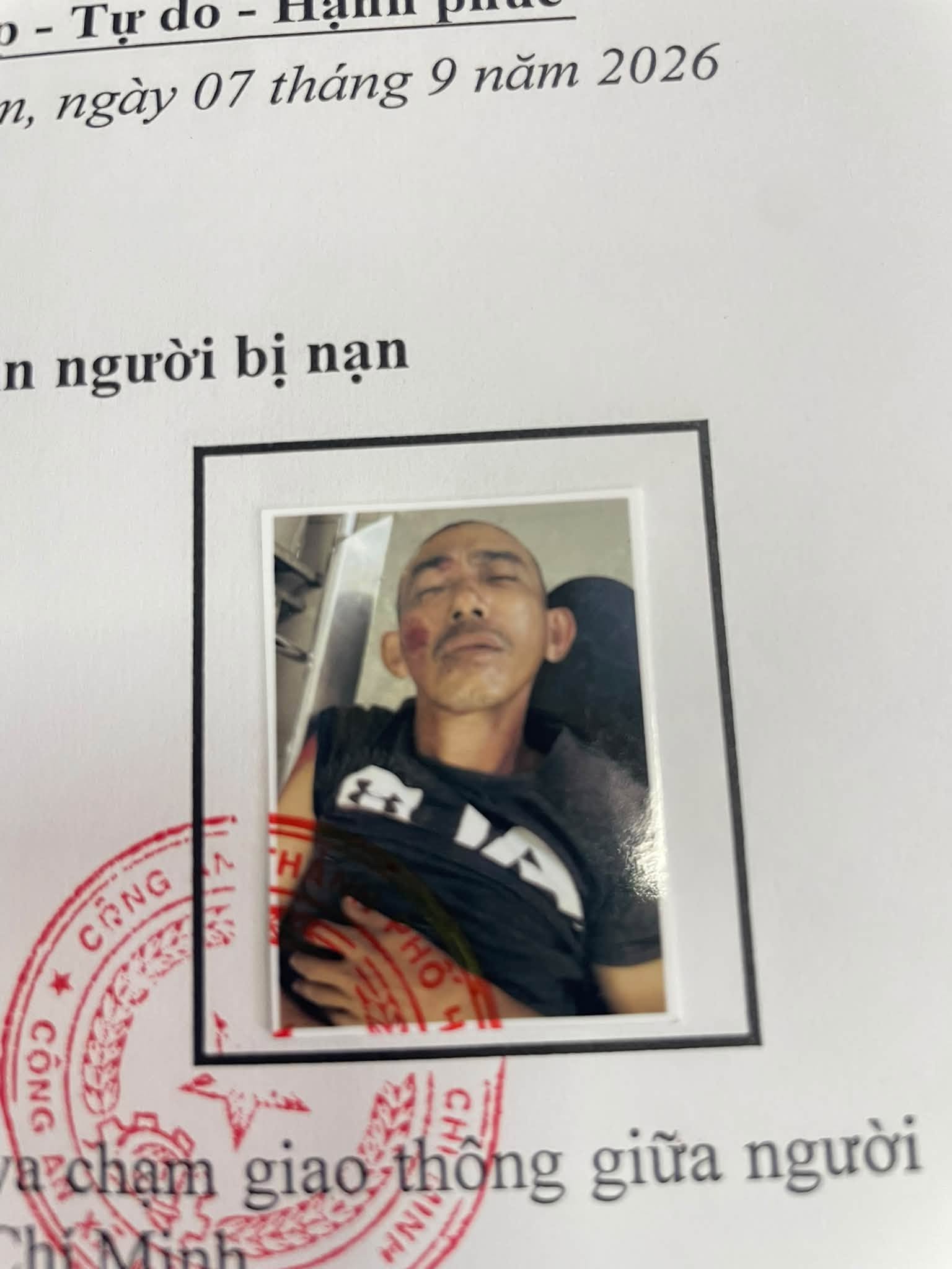 Công an tìm người thân cho người đàn ông chấn thương bên lề đường TP . HCM - Ảnh 1. Công an tìm người thân cho người đàn ông chấn thương bên lề đường TP . HCM - Ảnh 1.
