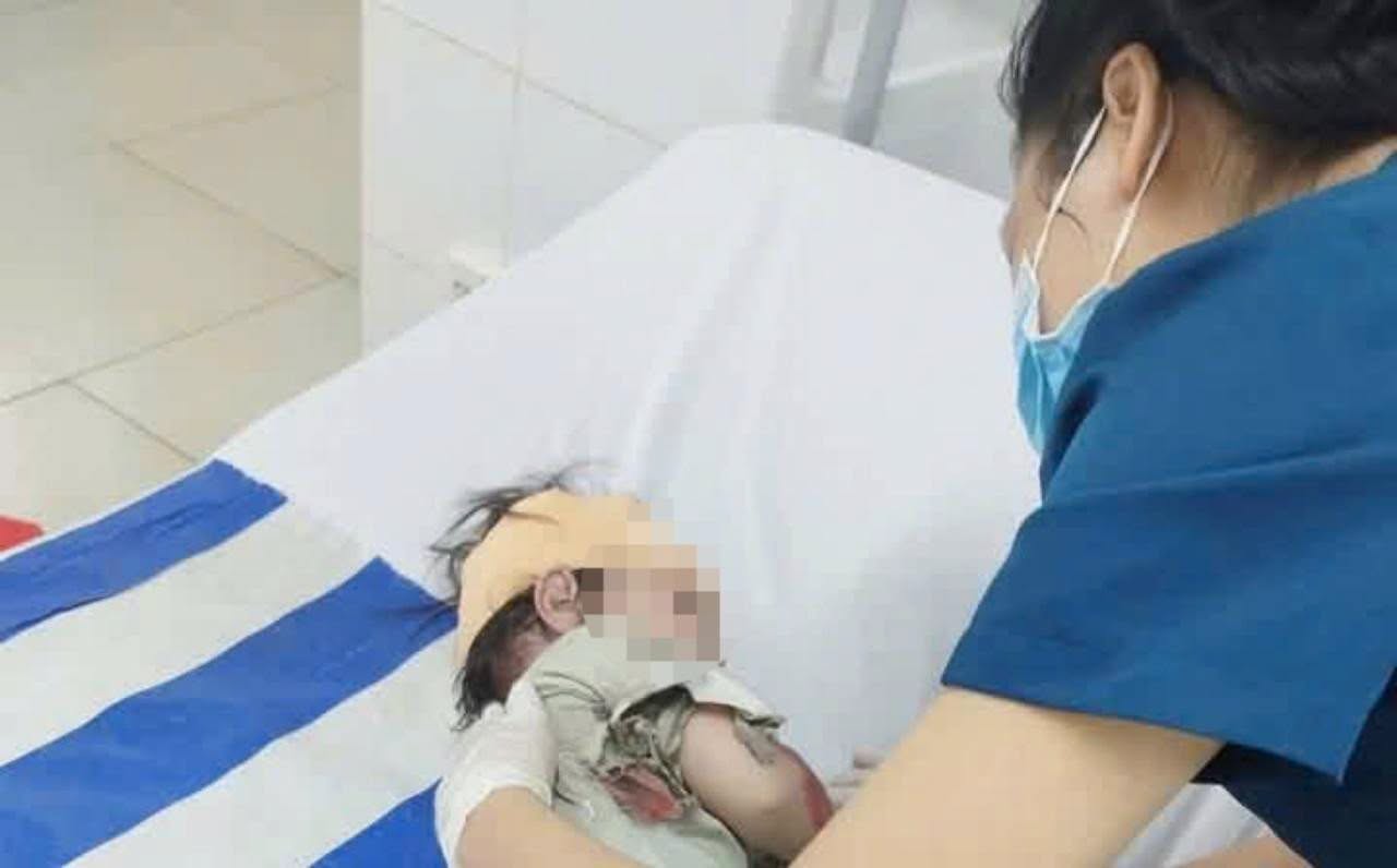 T&igrave;nh trạng sức khỏe b&eacute; g&aacute;i 32 th&aacute;ng tuổi sống s&oacute;t trong vụ tai nạn ở Đồng Nai - Ảnh 1.