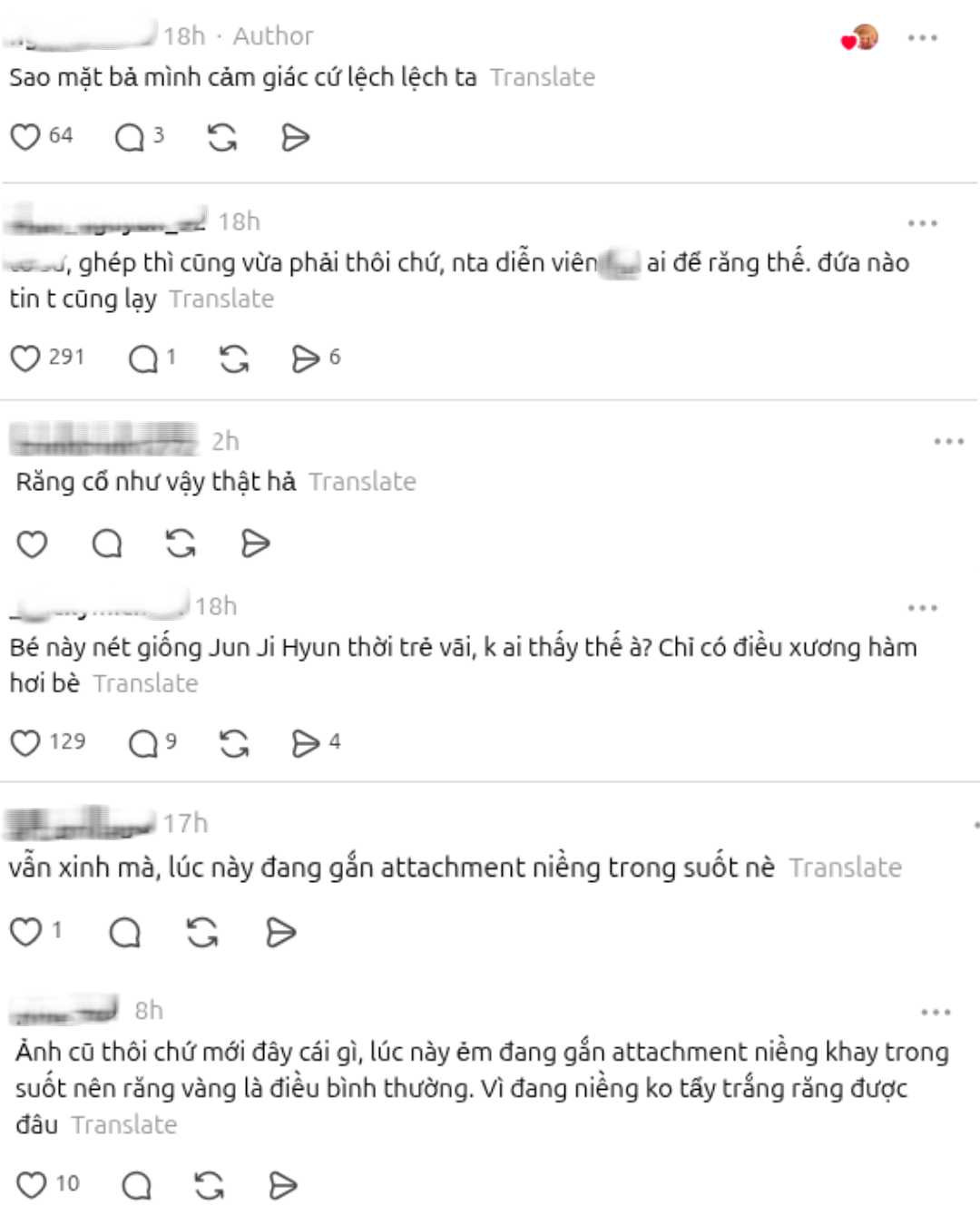 T&ocirc;n Thi&ecirc;n v&agrave; sự thật về Nhan sắc: Răng v&agrave;ng g&acirc;y tranh c&atilde;i trong cộng đồng mạng - Ảnh 4.