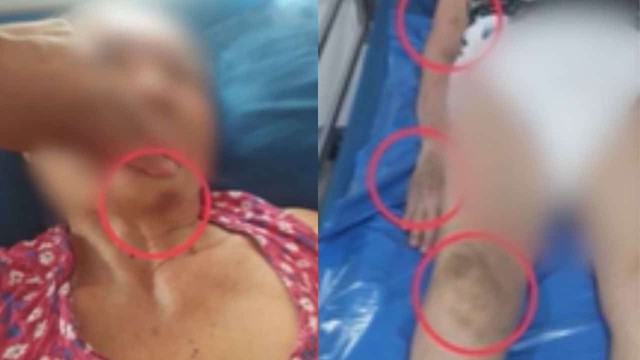 Bạo h&agrave;nh người gi&agrave; tại Th&aacute;i Lan: Đau l&ograve;ng c&acirc;u chuyện mẹ 78 tuổi bị ngược đ&atilde;i - Ảnh 3.