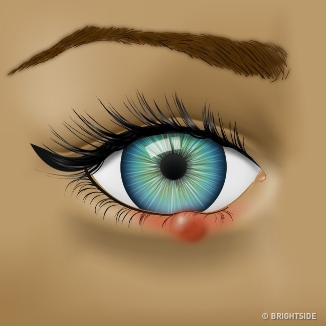 Nhận biết tình trạng sức khỏe qua những dấu hiệu của mắt - Ảnh 2.