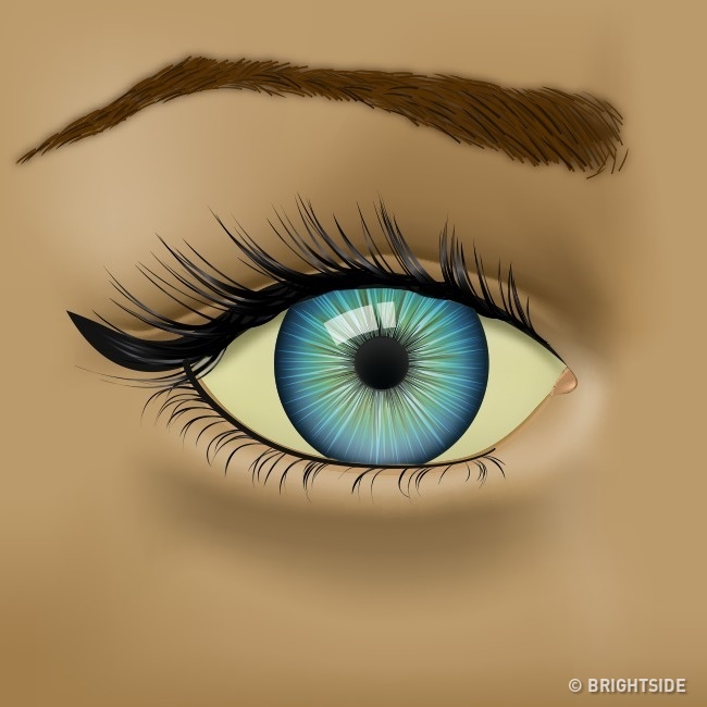 Nhận biết tình trạng sức khỏe qua những dấu hiệu của mắt - Ảnh 6.