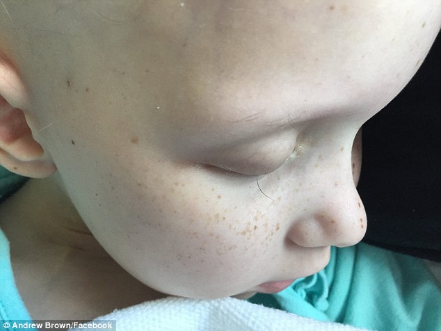 Phép màu đã đến với bé gái 7 tuổi bị ung thư trong bức ảnh sợi lông mi cuối cùng - Ảnh 1.