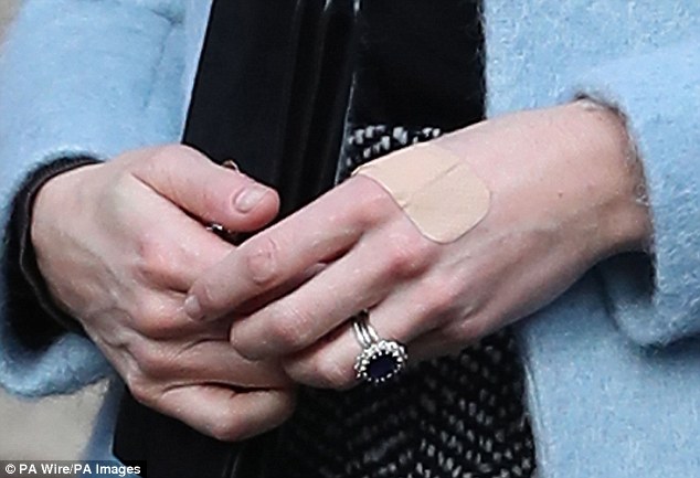 Có một điểm đặc biệt trên đôi tay Công nương Kate mà không phải ai cũng nhận ra - Ảnh 1.