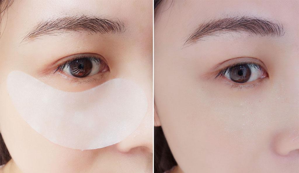 5 loại mặt nạ có tác dụng cải thiện rõ rệt vùng quầng thâm dưới mắt - Ảnh 13.