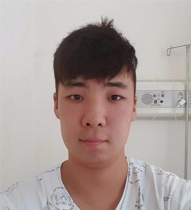 Ham nhuộm tóc giá rẻ, chàng thanh niên nhận lại quả đầu sưng to, mắt không mở được - Ảnh 15. Ham nhuộm tóc giá rẻ, chàng thanh niên nhận lại quả đầu sưng to, mắt không mở được - Ảnh 15.