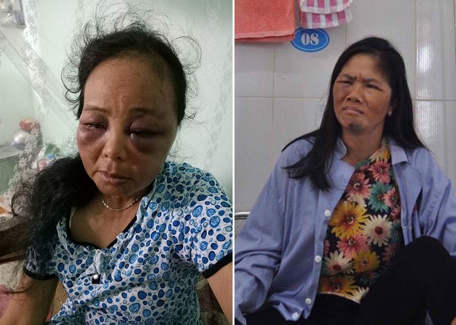 Vụ 2 phụ nữ bán tăm bị đánh: Bà nội cháu bé nghi bị bắt cóc lên tiếng - Ảnh 2.