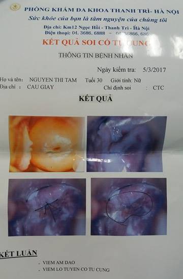 Vụ thai phụ hôn mê sau khi khám thai: Người mẹ cẩn trọng với những bệnh phụ khoa khi mang thai - Ảnh 4.