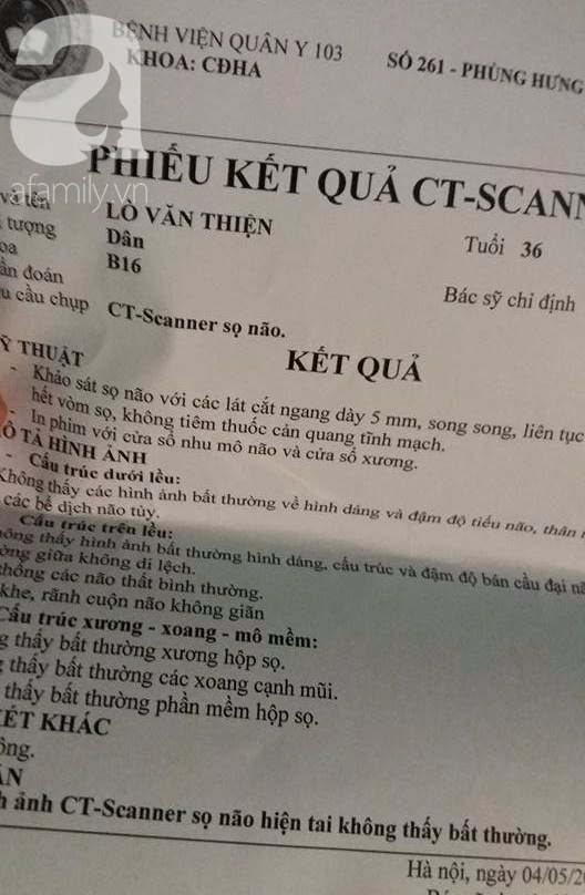 Lời kể của công nhân thoát chết trong vụ sập giàn giáo tại công trình chung cư đang xây - Ảnh 6.