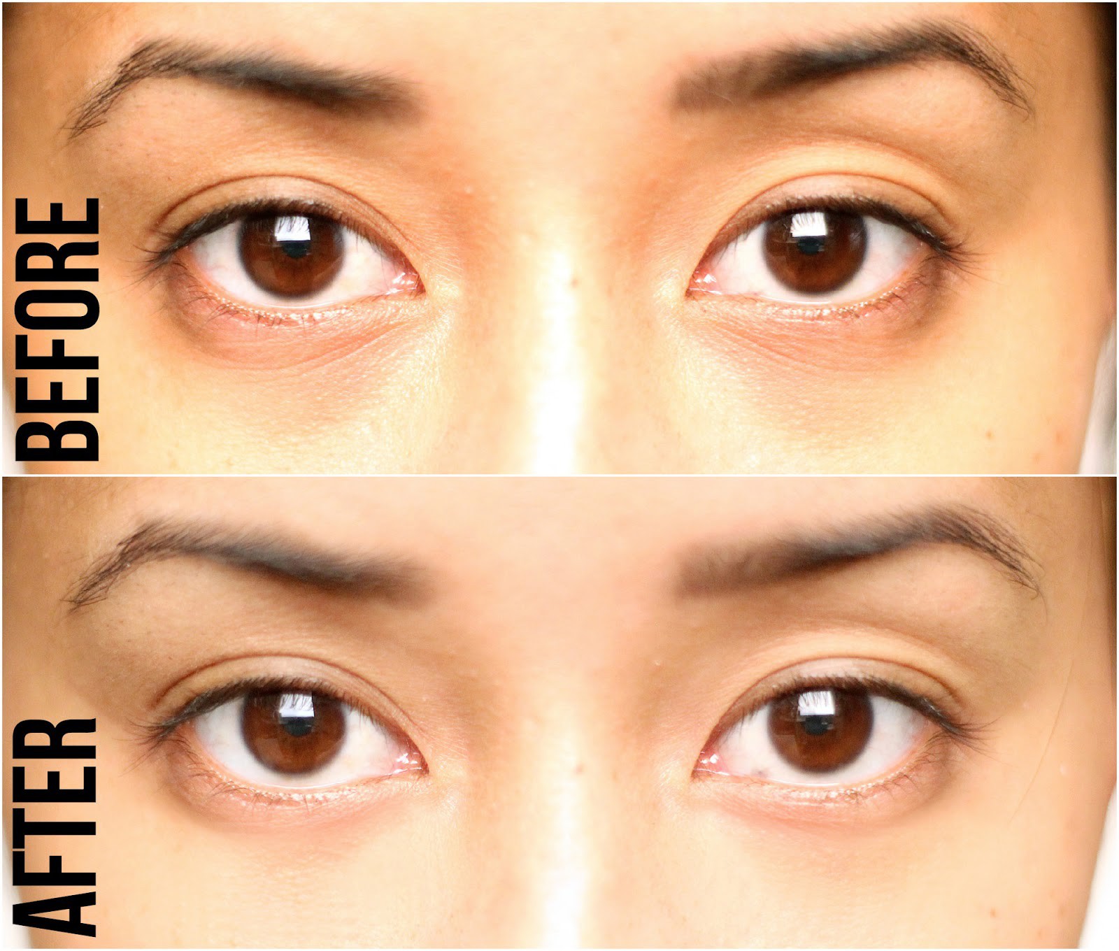 5 loại mặt nạ có tác dụng cải thiện rõ rệt vùng quầng thâm dưới mắt - Ảnh 19.